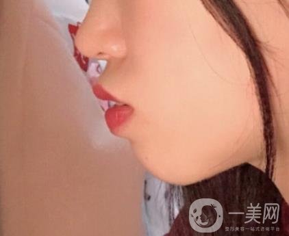 復(fù)旦大學(xué)附屬兒科醫(yī)院口腔科做牙齒矯正多少錢？?jī)r(jià)格表明細(xì)一覽
