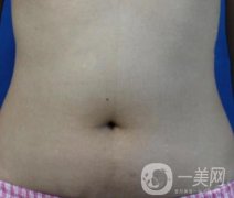 哈爾濱醫(yī)科大學(xué)附屬第一醫(yī)院整形科價(jià)格表和吸脂瘦肚子全新公布