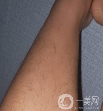 哈醫(yī)大四院整形美容科價(jià)格表鉅惠來襲，附冰點(diǎn)脫毛案例