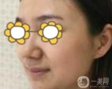 阜陽市人民醫(yī)院整形美容科價(jià)格表2020版，附*案例