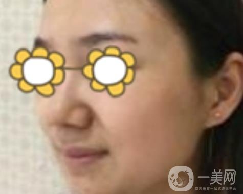 阜陽市人民醫(yī)院整形美容科價格表2020版，附*案例