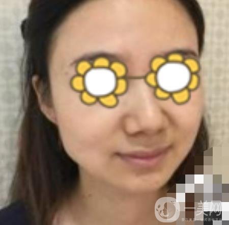 阜陽市人民醫(yī)院整形美容科價格表2020版，附*案例