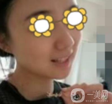 阜陽市人民醫(yī)院整形美容科價格表2020版，附*案例