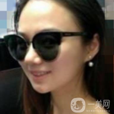阜陽市人民醫(yī)院整形美容科價格表2020版，附*案例