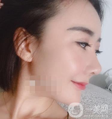 哈爾濱醫(yī)大二院整形美容科價(jià)格表上線，附*案例