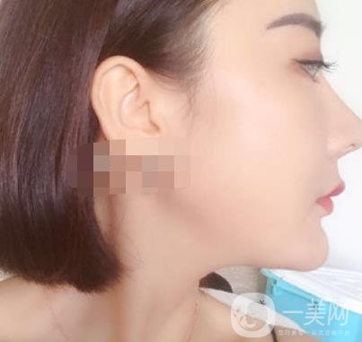 哈爾濱醫(yī)大二院整形美容科價(jià)格表上線，附*案例