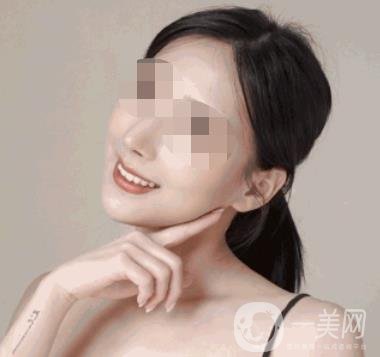 河南省人民醫(yī)院整形美容科價(jià)格表公布，附除腋臭案例