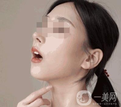 河南省人民醫(yī)院整形美容科價(jià)格表公布，附除腋臭案例