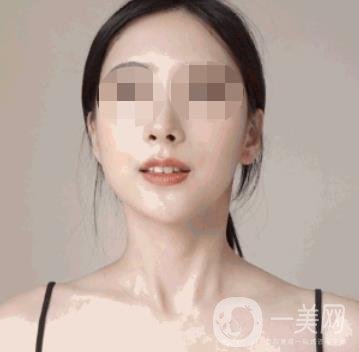 河南省人民醫(yī)院整形美容科價(jià)格表公布，附除腋臭案例