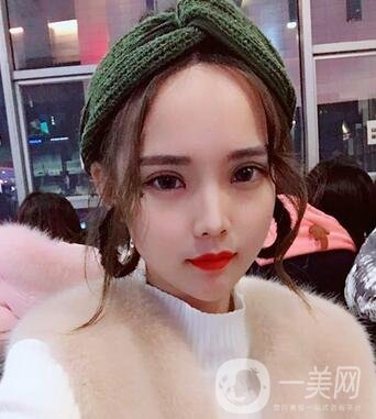 湖南第一醫(yī)院整形科價格表，附雙眼皮案例
