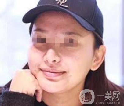 西南醫(yī)院*多少錢?附整形價格表及真實案例