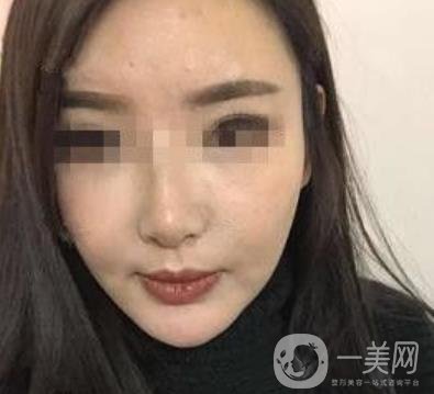西南醫(yī)院*多少錢?附整形價格表及真實案例