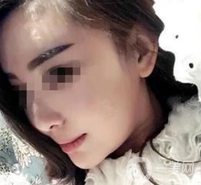 西南醫(yī)院*多少錢?附整形價格表及真實案例