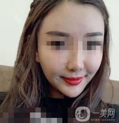 西南醫(yī)院*多少錢?附整形價格表及真實案例