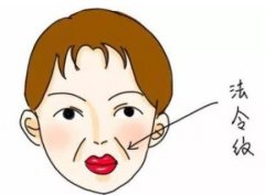 臉上出現(xiàn)法令紋顯老怎么辦？可以試試填充來(lái)解決凹陷