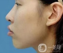 被“凸嘴!”封印的顏值，該如何解決？