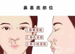 玻尿酸注射鼻基底果如何?看專(zhuān)家詳解鼻基底的重要性