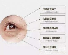 超聲波去眼袋果好嗎？看文章里面都解釋清楚了
