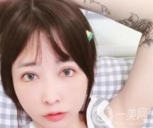 為什么不建議女性割這幾種形狀雙眼皮！看完文章你還要做嗎？