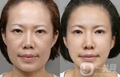 女明星都在做的熱瑪吉究竟有哪些果呢？原來(lái)抗初老全靠它