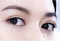 雙眼皮是埋線好還是全切好?雙眼皮手術(shù)方法有哪些?
