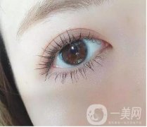 雙眼皮埋線和全切哪個(gè)自然?雙眼皮的形狀如何選擇?