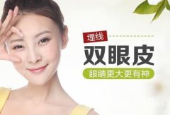 埋線雙眼皮多少錢?埋線雙眼皮有什么特點?