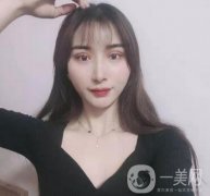 處楊明勇做雙眼皮怎么樣？專(zhuān)家案例_價(jià)格（價(jià)目）收費(fèi)反饋~