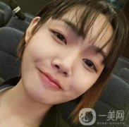 西京整形科價(jià)格表收費(fèi)標(biāo)準(zhǔn)多方面一覽！含專家雙眼皮案例術(shù)后照~