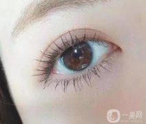 割雙眼皮要多少錢?雙眼皮價格受哪些因素影響?