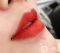 漂唇之后多久可以消腫?有什么護(hù)理措施？