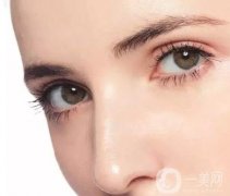 雙眼皮整形手術(shù)有哪些?雙眼皮整形手術(shù)有哪些注意事項？