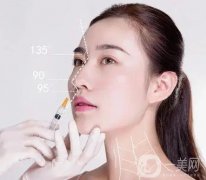 鼻頭縮小如何預(yù)防增生?為什么鼻頭縮小會增生?