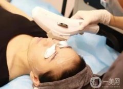 光子嫩膚后有哪些注意事項？生物刺激作用是什么？