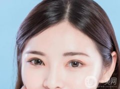 韓式三點雙眼皮優(yōu)缺點是什么？適應哪些人群？
