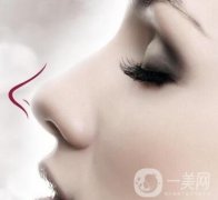縮鼻手術(shù)后遺癥是什么?術(shù)后怎么護(hù)理?