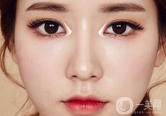 開眼角后的疤痕可以修復嗎?術后怎么做眼角疤痕很快消失?
