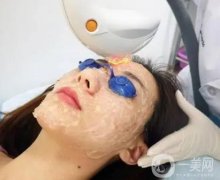 光子嫩膚有沒有依賴性？美容院的光子嫩膚和醫(yī)院的一樣嗎？