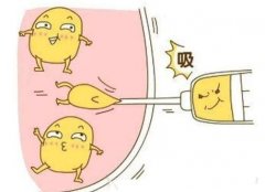 大腿環(huán)吸是什么意思？有哪些問題需要注意？