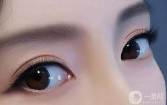 割雙眼皮有多大的危害?