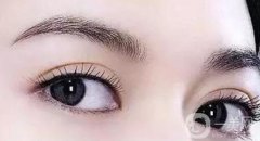 開眼角會留下疤痕嗎?開眼角會不會影響視力?