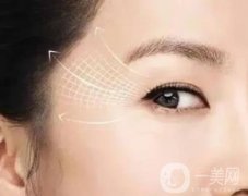 激光去魚尾紋有沒有副作用？激光去除魚尾紋的風險是什么？