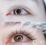 嫁接睫毛的詳細(xì)步驟是怎么樣的？要點(diǎn)是什么？