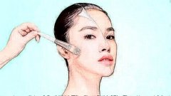 激光去痘印疼嗎，去除痘印后為什么會留下疤痕?