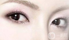 開眼角之后會出現(xiàn)疤痕增生嗎?