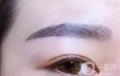 眉毛高低不一能否補救?