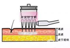 *的作用是什么呢?注意事項有哪些?