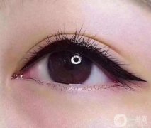 美瞳線多久可以恢復(fù)？紋美瞳線的原因是什么？