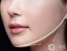 面部吸脂*性的決定因素是什么？*嗎？