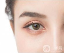 微雕雙眼皮的優(yōu)點及適應(yīng)人群